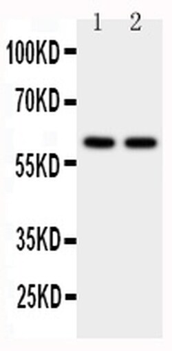 Invitrogen CYP11A1 Polyclonal Antibody 100 &mu;g; Unconjugated:Antibodies,