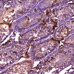 Invitrogen CYP17A1 Polyclonal Antibody 100 &mu;g; Unconjugated:Antibodies,