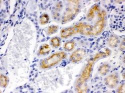 Invitrogen CYP24A1 Polyclonal Antibody 100 &mu;g; Unconjugated:Antibodies,