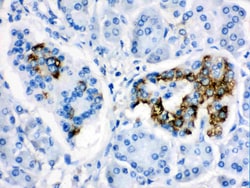 Invitrogen CYP24A1 Polyclonal Antibody 100 &mu;g; Unconjugated:Antibodies,