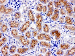 Invitrogen CYP24A1 Polyclonal Antibody 100 &mu;g; Unconjugated:Antibodies,