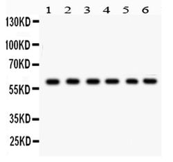 Invitrogen CYP24A1 Polyclonal Antibody 100 &mu;g; Unconjugated:Antibodies,