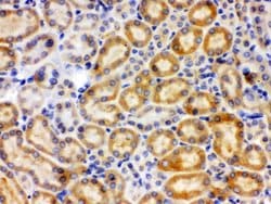 CYP27B1 Polyclonal Antibody:Antibodies, Polyclonal
