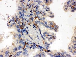 CYP27B1 Polyclonal Antibody:Antibodies, Polyclonal