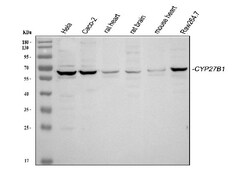 CYP27B1 Polyclonal Antibody:Antibodies, Polyclonal