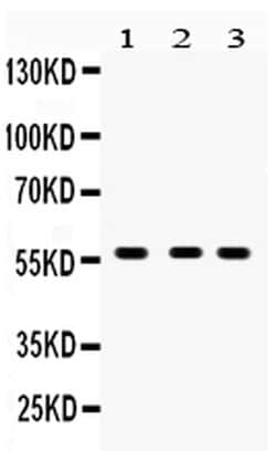 CYP27B1 Polyclonal Antibody:Antibodies, Polyclonal