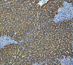 Invitrogen CYP2E1 Polyclonal Antibody 100 &mu;g; Unconjugated:Antibodies,