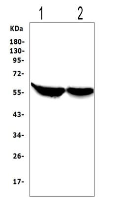 Invitrogen CYP2E1 Polyclonal Antibody 100 &mu;g; Unconjugated:Antibodies,