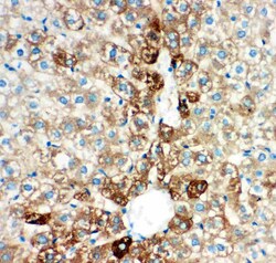 Invitrogen CYP2E1 Polyclonal Antibody 100 &mu;g; Unconjugated:Antibodies,