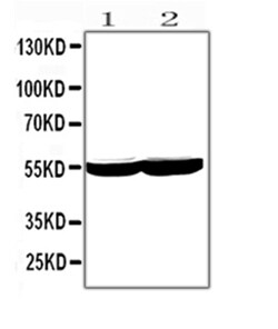 Invitrogen CYP2E1 Polyclonal Antibody 100 &mu;g; Unconjugated:Antibodies,
