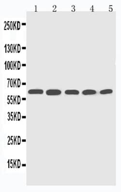 Invitrogen CYP2U1 Polyclonal Antibody 100 &mu;g; Unconjugated:Antibodies,