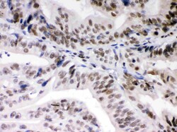 Invitrogen DAXX Polyclonal Antibody 100 &mu;g | Buy Online | Invitrogen&trade; | Fisher Scientific