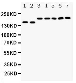 Invitrogen DCC Polyclonal Antibody 100 &mu;g; Unconjugated:Antibodies,