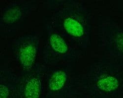 Invitrogen DCK Polyclonal Antibody 100 &mu;g; Unconjugated:Antibodies,
