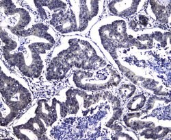 Invitrogen DCK Polyclonal Antibody 100 &mu;g; Unconjugated:Antibodies,