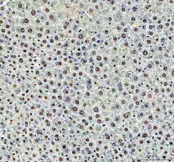 Invitrogen DCK Polyclonal Antibody 100 &mu;g; Unconjugated:Antibodies,