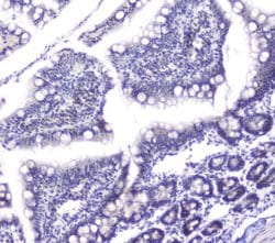 Invitrogen DCK Polyclonal Antibody 100 &mu;g; Unconjugated:Antibodies,