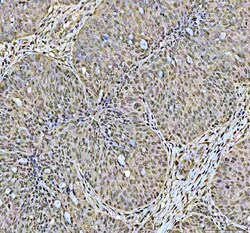 Invitrogen DCK Polyclonal Antibody 100 &mu;g; Unconjugated:Antibodies,