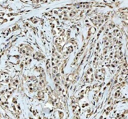 Invitrogen DCK Polyclonal Antibody 100 &mu;g; Unconjugated:Antibodies,