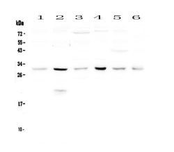 Invitrogen DCK Polyclonal Antibody 100 &mu;g; Unconjugated:Antibodies,