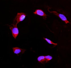 Invitrogen DDAH2 Polyclonal Antibody 100 &mu;g; Unconjugated:Antibodies,