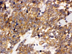 Invitrogen DDAH2 Polyclonal Antibody 100 &mu;g; Unconjugated:Antibodies,