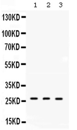 Invitrogen DDAH2 Polyclonal Antibody 100 &mu;g; Unconjugated:Antibodies,