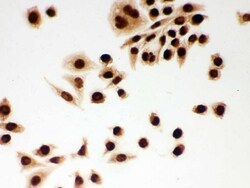 Invitrogen DDB1 Polyclonal Antibody 100 &mu;g; Unconjugated:Antibodies,