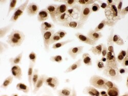 Invitrogen DDB1 Polyclonal Antibody 100 &mu;g; Unconjugated:Antibodies,