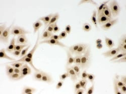 Invitrogen DDB1 Polyclonal Antibody 100 &mu;g; Unconjugated:Antibodies,