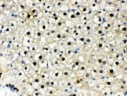 Invitrogen DDB1 Polyclonal Antibody 100 &mu;g; Unconjugated:Antibodies,