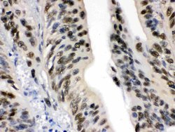 Invitrogen DDB1 Polyclonal Antibody 100 &mu;g; Unconjugated:Antibodies,