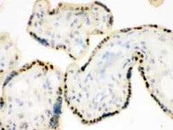 Invitrogen DDB1 Polyclonal Antibody 100 &mu;g; Unconjugated:Antibodies,