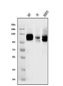 Invitrogen DDR2 Polyclonal Antibody 100 &mu;g; Unconjugated:Antibodies,