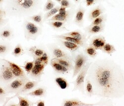 Invitrogen DDX4 Polyclonal Antibody 100 &mu;g; Unconjugated:Antibodies,