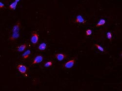 Invitrogen DDX4 Polyclonal Antibody 100 &mu;g; Unconjugated:Antibodies,