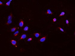 Invitrogen DDX4 Polyclonal Antibody 100 &mu;g; Unconjugated:Antibodies,