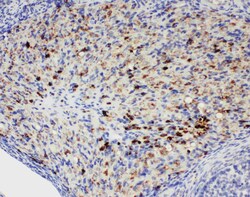 Invitrogen DDX4 Polyclonal Antibody 100 &mu;g; Unconjugated:Antibodies,