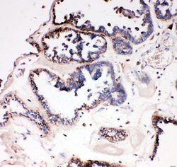 Invitrogen DDX4 Polyclonal Antibody 100 &mu;g; Unconjugated:Antibodies,