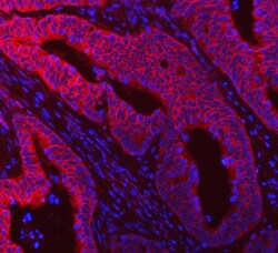 Invitrogen RIG-I Polyclonal Antibody 100 &mu;g; Unconjugated:Antibodies,