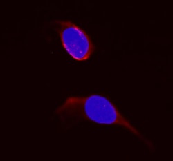 Invitrogen DHFR Polyclonal Antibody 100 &mu;g; Unconjugated:Antibodies,