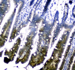 Invitrogen DHFR Polyclonal Antibody 100 &mu;g; Unconjugated:Antibodies,