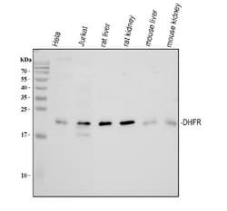 Invitrogen DHFR Polyclonal Antibody 100 &mu;g; Unconjugated:Antibodies,
