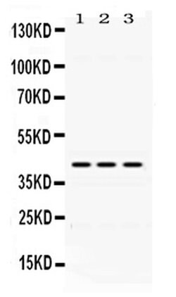 Invitrogen DHODH Polyclonal Antibody 100 &mu;g; Unconjugated:Antibodies,