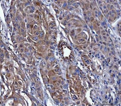 Invitrogen Dicer Polyclonal Antibody 100 &mu;g; Unconjugated:Antibodies,