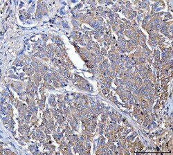 Invitrogen Dicer Polyclonal Antibody 100 &mu;g; Unconjugated:Antibodies,