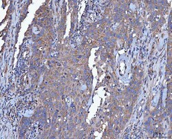 Invitrogen Dicer Polyclonal Antibody 100 &mu;g; Unconjugated:Antibodies,