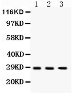 DKK2 Polyclonal Antibody:Antibodies, Polyclonal