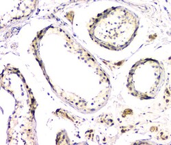 Invitrogen DMRT1 Polyclonal Antibody 100 &mu;g; Unconjugated:Antibodies,