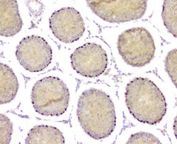 Invitrogen DMRT1 Polyclonal Antibody 100 &mu;g; Unconjugated:Antibodies,